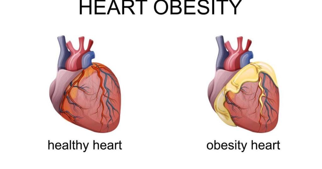 Ilustração da gordura pericárdica ao redor do coração, destacando seus riscos para a saúde cardiovascular