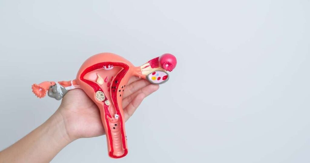 Imagem que representa a conscientização sobre a endometriose, destacando a importância do diagnóstico precoce.