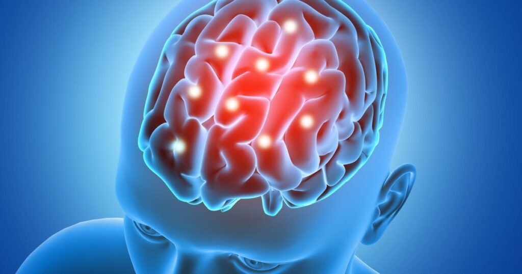 Ilustração de um marcapasso cerebral e eletrodos no cérebro humano